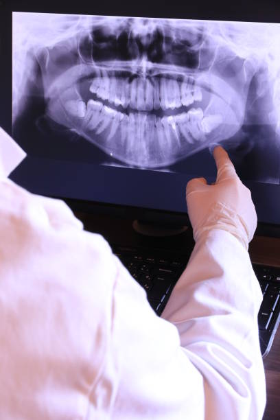Best Emergency Tooth Extraction in Benton, TN