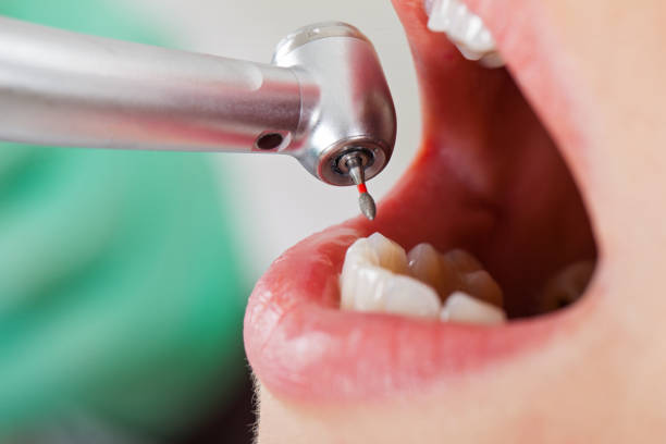 Best Same-Day Emergency Dental Services in Benton, TN